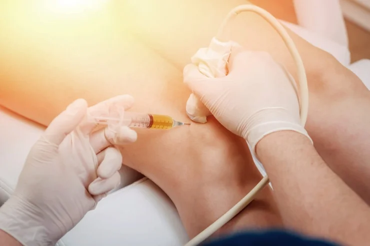 Fluoroscopic-Guided Pain Injections