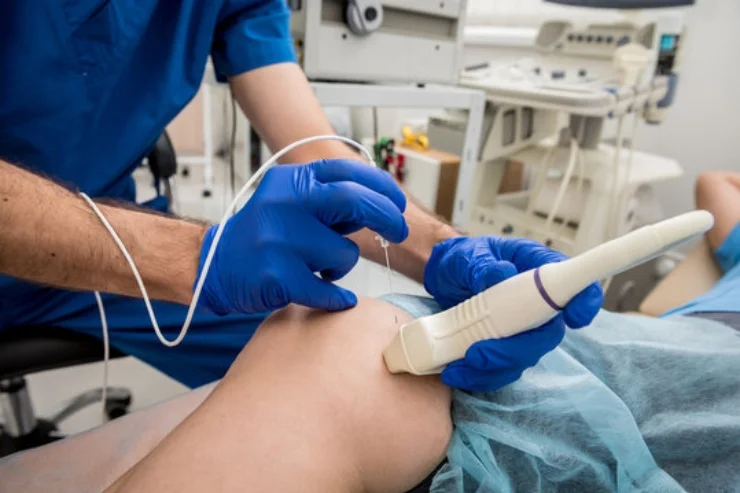 Radiofrequency Ablation